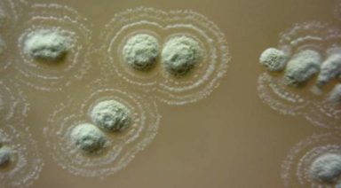 Antibiotic-Resistant Superbugs No Match for Ancient Irish Soil