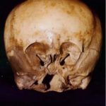 Star Child Skull Proved Human, But How Accurate Is DNA Testing?