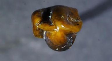 Could Discovery of 9.7 Million Year Old Teeth Rewrite History?