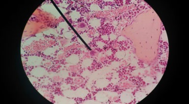 A Mexican Scientist Has Cured HPV With Oxygen and Light Frequency