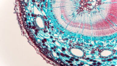 Stem Cells From One's Own Body Show Efficacy in Treating Pain