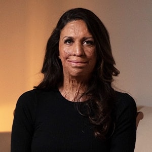 Turia Pitt